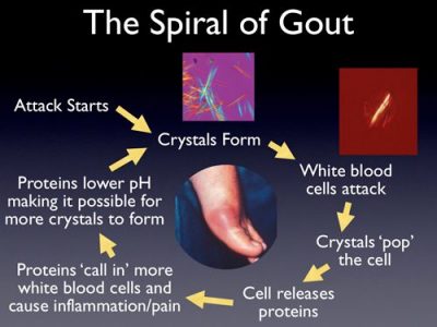 what causes gout