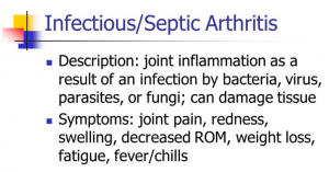 Septic Arthritis Symptoms