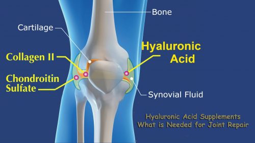 hyaluronic acid for joints