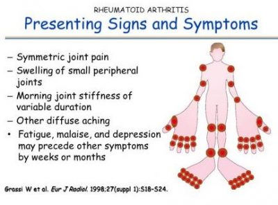 Rheumatoid Arthritis Signs