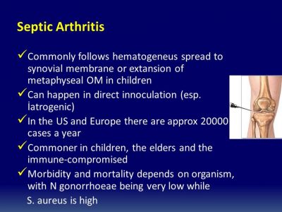 cause of septic arthritis