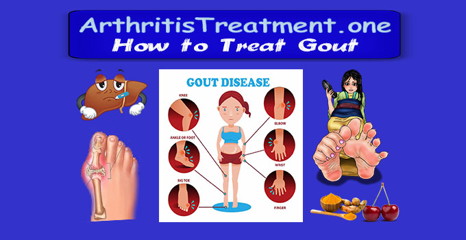 Treatment for Gout
